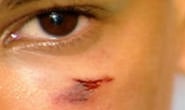 Adolescente é agredido e roubado no Centro