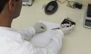 Estado desenvolve kit para diagnóstico rápido da dengue