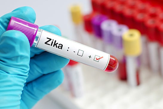 Planos de saúde já estão obrigados a pagar por exames de zika