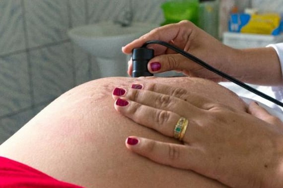 Pesquisa revela que grávidas acham exames do SUS insuficientes para microcefalia