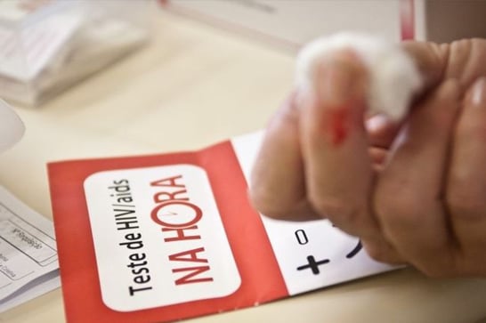 Aids: casos e óbitos caem 16% nos últimos quatro anos no Brasil