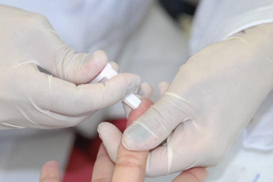 SES reforça importância do teste rápido de HIV