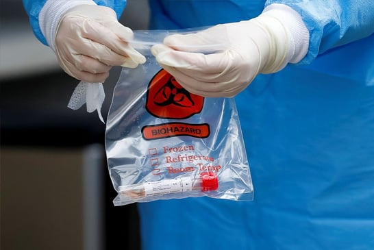 Covid-19: 500 mil kits de teste rápido chegam ao Brasil