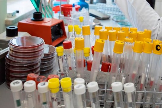 Brasil recebe 500 mil testes para diagnóstico de Covid-19