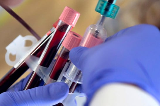 Araxá terá testes em massa para diagnosticar Covid-19 a partir desta semana, diz Secretaria de Saúde