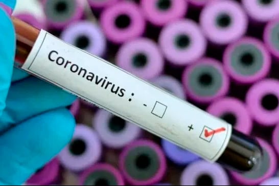 Boletim registra 27 novos casos de Covid-19 e 3 recuperados em 24 horas