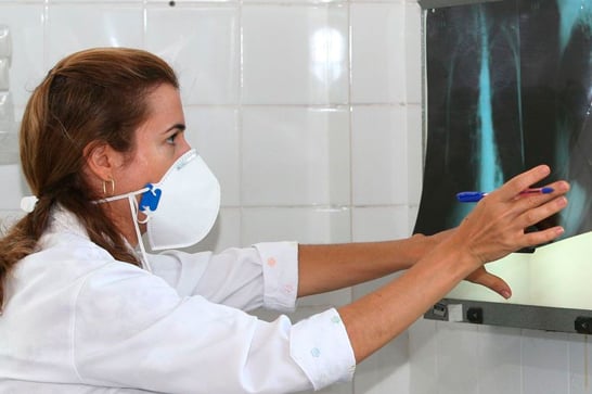 Ministério da Saúde aprova novas tecnologias para combate à tuberculose no SUS