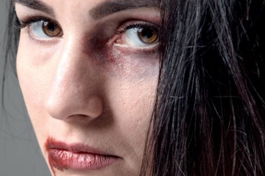 Prefeitura implementa Rede de Acolhimento à Mulher Vítima de Abuso